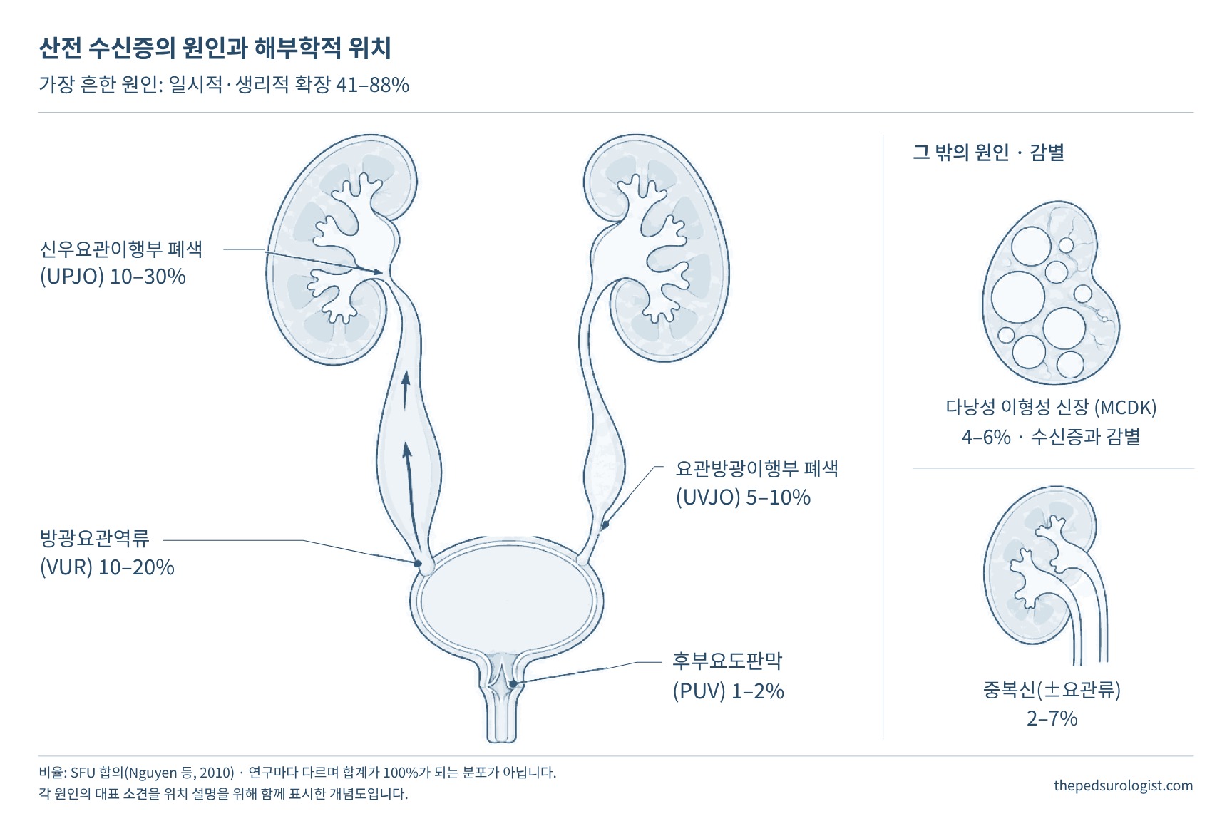 양쪽 콩팥, 요관, 방광, 요도를 그린 요로 그림 위에 산전 수신증의 원인을 위치별로 표시한 도식. 신우요관이행부 폐색 10~30%, 방광요관역류 10~20%, 요관방광이행부 폐색 5~10%, 후부요도판막 1~2%, 다낭성 이형성 신장 4~6%, 중복신(±요관류) 2~7%. 가장 흔한 일시적·생리적 확장은 41~88%