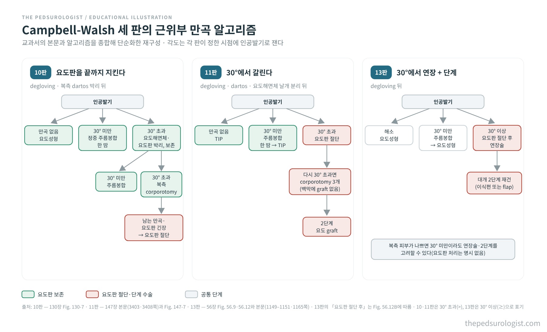 Campbell-Walsh Urology 10판, 11판, 13판의 근위부 요도하열 만곡 알고리즘을 만곡 없음, 30° 미만, 30° 초과 또는 이상의 세 갈래로 나란히 놓고 요도판 보존 단계와 요도판 절단 또는 단계 수술 단계를 색으로 구분한 비교 도식